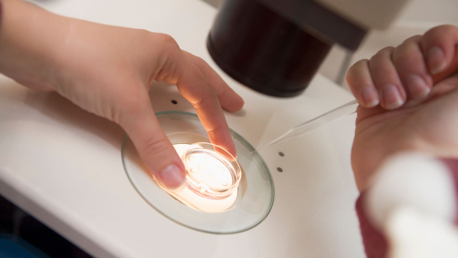 卵子の質をチェックする検査とは?